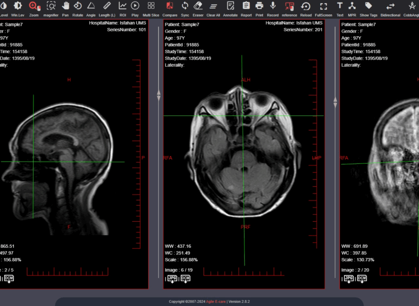 MRI